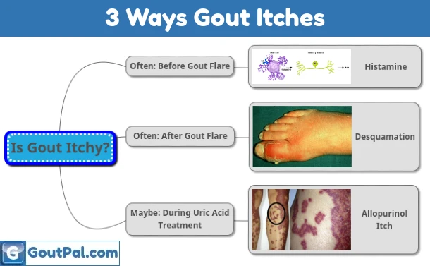 3 Ways Gout Itches