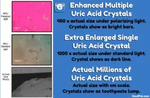 Uric Acid Crystal Magnification Pictures