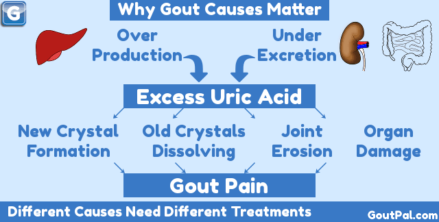 Why Gout Causes Matter Image
