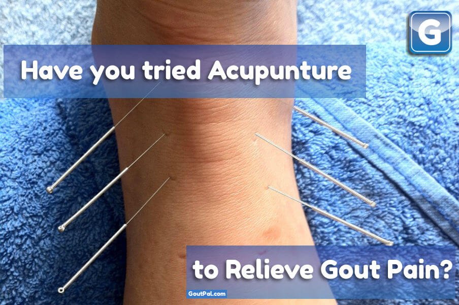 How do you Treat Gout Pain With Acupuncture?